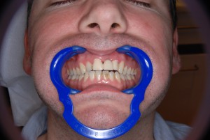dentalni-hygiena1.jpg